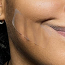 Pimple Patch XL – 10 Extra-Large Hydrocolloid Patches for Face and Body